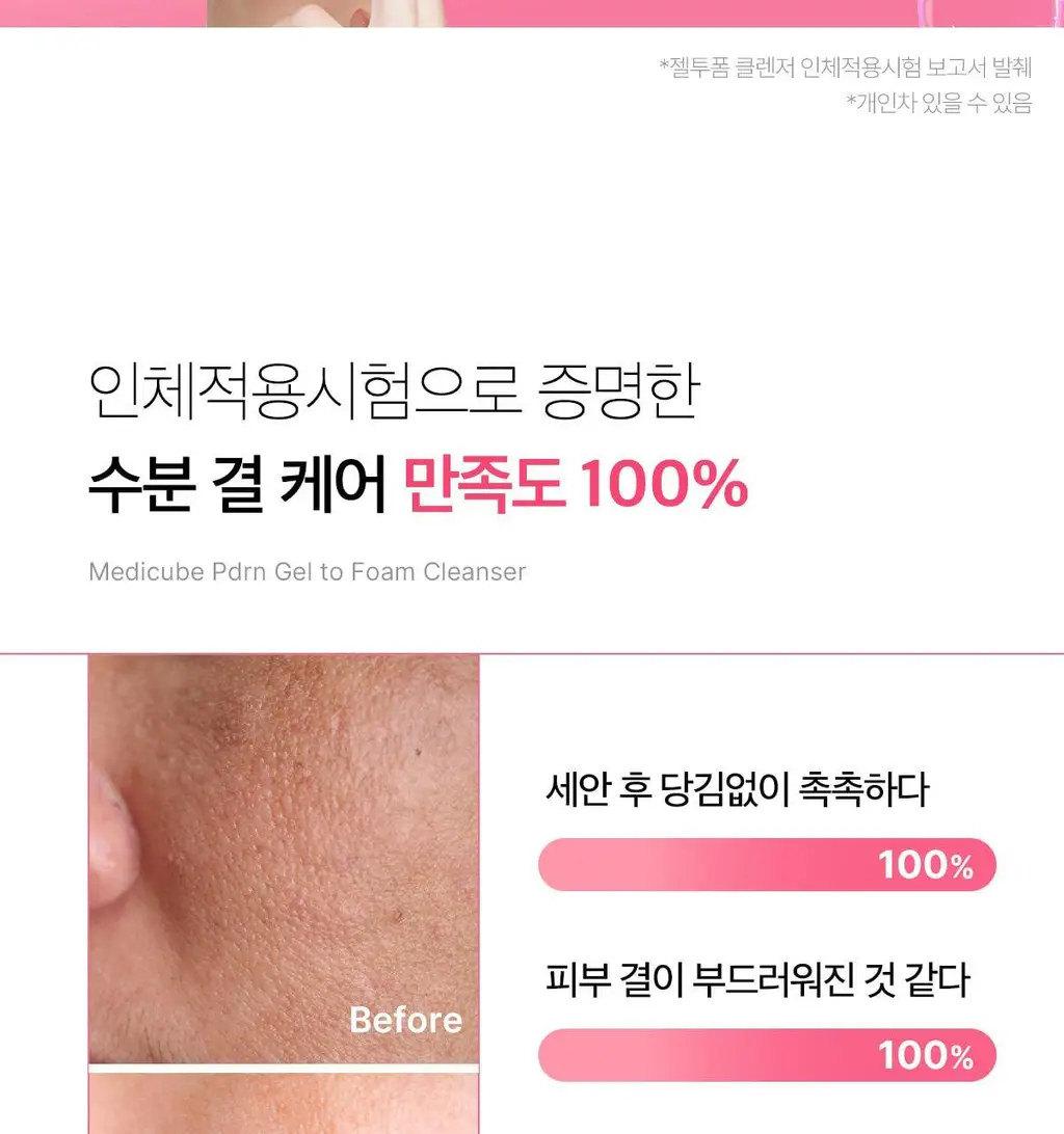 [저자극클렌저] 메디큐브 PDRN 젤투폼 클렌저 200ml 기획(+클렌징브러쉬 증정) 상세페이지 44
